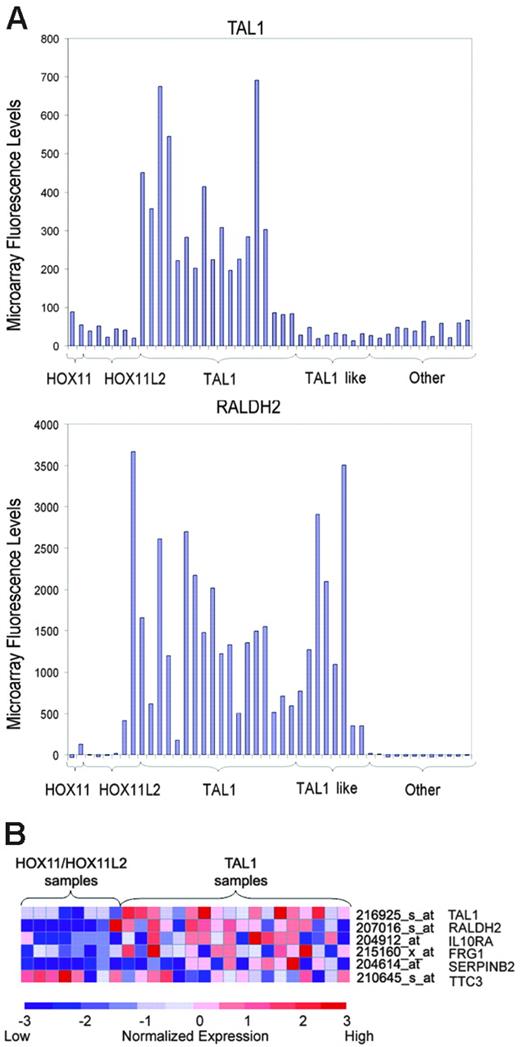 Figure 5. Expression profile of TAL1-direct targets in primary T-ALL samples. (A) Microarray fluorescence intensities corresponding to the expression of TAL1 and RALDH2 genes in T-ALL samples. High levels of expression of RALDH2 were detected in all TAL1-positive cases, in agreement with a role of TAL1 in the activation of this direct target gene. Cases were arranged on the basis of the expression of T-ALL oncogenes, including HOX11, HOX11L2, and TAL1. TAL1-like cases denote samples with high levels of RALDH2 similar to those present in TAL1-positive samples, but lacking TAL1 expression. (B) Heat map representing relative expression levels of TAL1 and TAL1 direct target genes in HOX11/HOX11L2-positive cases and TAL1-positive samples. Each column represents 1 of 26 samples positive for HOX11, HOX11L2, or TAL1 by RT-PCR, while each shows the expression pattern of a particular gene identified as a TAL target by ChIP on chip. Relative expression levels are normalized across the samples; levels greater than or less than the mean are shown in shades of red or blue, respectively.