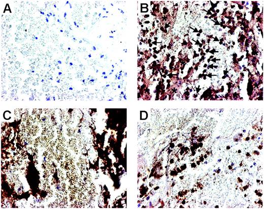 Figure 6. Localization of LIGHT in thrombus material. Photomicrographs showing immunostaining and localization of LIGHT in thrombus material removed from the site of plaque rupture in patients with STEMI undergoing PCI. Thrombus material stained with omission of the primary antibody served as control and demonstrated no immunostaining of any of the cellular elements (A). Fairly strong immunostaining of LIGHT (B) was seen in areas with platelets (*) and in monocytes/macrophages (arrows). Panel C demonstrates thrombus material with CD41+platelets, and panel D demonstrates calprotectin-positive monocytes/macrophages. Original magnification ×400.