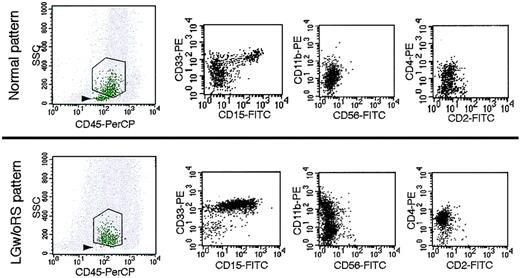 Figure 2. Representative patterns of FCM of controls and LGw/oRS patients. Stage I hematogones usually formed an easily detectable cluster (arrowhead, top left panel) in controls but were undetectable or faint in LGw/oRS patients (arrowhead, bottom left panel). Abnormally high expression of CD15, CD33, CD11b, and CD4 was observed in LGw/oRS patients (3 bottom right panels) in comparison with the normal expression pattern of these antigens in a control (3 top right panels).