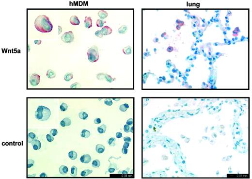 Figure 2. WNT5A expression in human monocyte-derived and alveolar macrophages. Qualitative detection of WNT5A mRNA expression by in situ hybridization with a WNT5A-specific probe (top row). Human monocyte-derived macrophages (hMDM) were analyzed after cultivation for 4 hours. Human uninvolved lung tissues obtained during tumor surgery (5 individuals; one representative shown) were analyzed. (Bottom row) In situ hybridization with a nonspecific scrambled DNA probe.