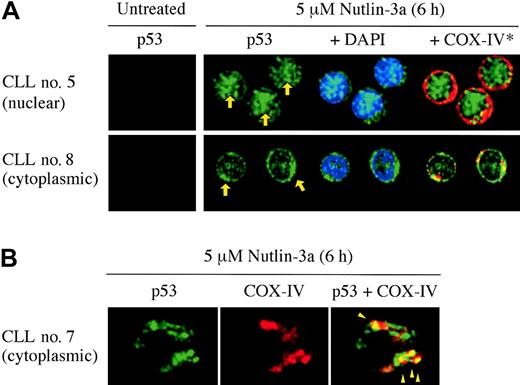 Figure 5. p53 relocation after Nutlin-3a treatment. (A) Representative p53 localization patterns (arrows) in primary CLL cells from patient no. 5 (nuclear accumulation) and no. 8 (cytoplasmic accumulation), which were treated with 5 μM Nutlin-3a for 6 hours. Cells were stained for p53 (green) and mitochondrial marker protein cytochrome c oxidase IV (red) and visualized by confocal microscopy. Nuclei were counterstained with DAPI (blue). (B) Preferential translocation of cytoplasmic p53 to mitochondria in CLL cells. Localization of p53 to mitochondria is indicated by the yellow-orange color in the merged image (arrowheads).