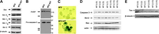 Figure 2. Persistent telomerase inhibition is not associated with apoptosis but induces senescence in HTLV-I–infected cells. (A) Western blot analysis for expression of apoptosis regulators in untreated MT-2 or treated with AZT (18 weeks). Equal amounts (50 μg) of each extract were used and confirmed by β-tubulin. (B) Absence of cleavage for procaspase 3 or PARP in AZT-treated MT-2 cells. (C) Senescence β-gal (SA-β gal) assay in MT-2 cells untreated and treated with AZT (18 weeks). A significant amount of senescence was detected only in end of cultures. (D) Western blot analysis of MT-2 cells treated with AZT. Samples were collected at different times after treatment from 0 to 15 weeks. Expression of caspase 3, Bcl-2, and Bax was tested. Actin was used as loading control. (E) Western blot analysis of MT-2 cells treated with AZT. Samples were collected at different times after treatment from 0 to 15 weeks. Expression of Tax was analyzed as described in “Patients, materials, and methods.” Beta-tubulin was used to confirm equal loading.