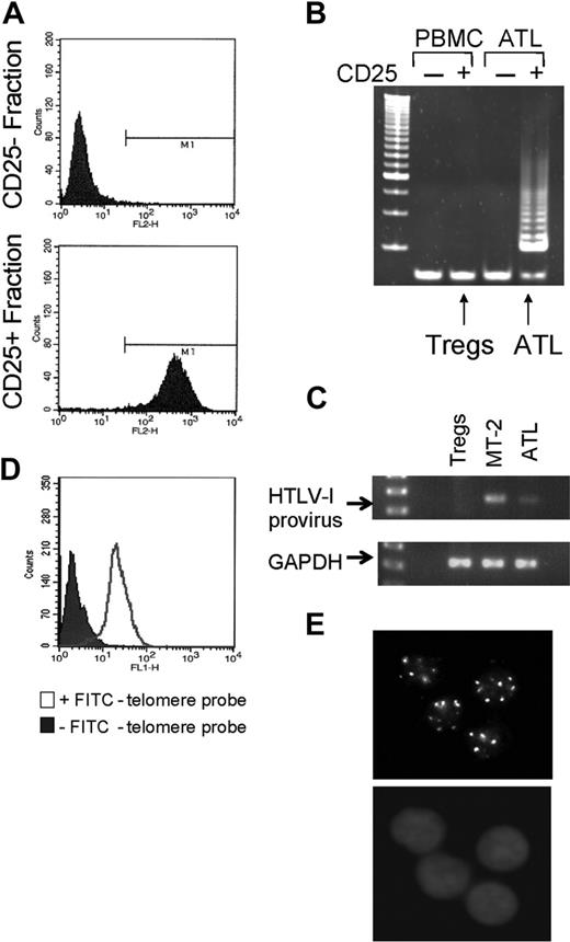 Figure 5. Analysis of CD25+ HTLV-I–infected cells. (A) FACS analysis of the presence of CD25 marker expression from CD25+ and CD25– sorted cells. (B) Telomerase activity detected by TRAP assay in CD25+ and CD25– fractions isolated from an HTLV-I donor and ATL PBMCs. (C) Integrated HTLV-I proviral DNA was detected by PCR using primers in the tax coding region. GAPDH was used as amplification control to ensure proper quality and quantity of extracted DNAs. (D) Staining control of PBMCs in presence or absence of FITC-telomere probe. (E) In situ hybridization of FITC-conjugated telomere probe (top) and DAPI (4′6-diamidino-2-phenylindole 2HCl) (bottom).