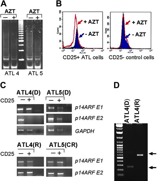 Figure 6. AZT-induced telomerase inhibition and telomere shortening in ATL patients. (A) Inhibition of telomerase activity measured by TRAP in vivo in ATL patients before and during treatment with AZT. (B) FACS analysis of telomere size by Flow-FISH in CD25+ and CD25– cells isolated from uncultured ATL patient samples. (C) Detection of exon 1 and 2 of the p14ARF gene by PCR in CD25+ cells from 2 ATL patients before AZT treatment or after AZT treatment; GAPDH amplification was used as control. D indicates diagnosis; R, relapse/death; and CR, complete remission. (D) Detection of provirus integration site by inverse PCR before and after AZT treatment. Arrows indicate different integration sites by inverse PCR.