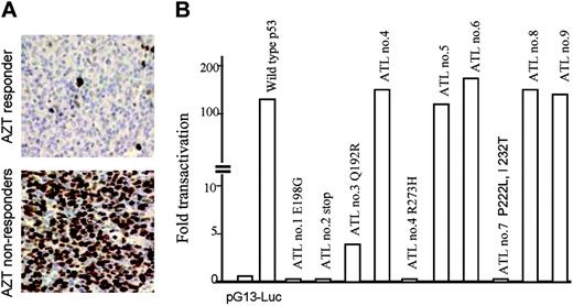 Figure 7. Response of ATL patients to AZT-based therapy correlates with their p53 transcriptional status. (A) Immunohistochemistry detection of p53 expression in ATL samples collected from AZT responder (top) and nonresponders (bottom) performed as previously described.3 (B) p53 from ATL patients was cloned into pCDNA3.1 and tested in a functional assay. Jurkat T cells were transfected with a p53-responsive vector and p53 expression vectors and luciferase activity detected 24 hours later. Results are representative of 2 independent experiments.