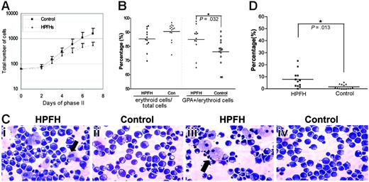 Figure 1. Erythroid cell growth, maturation, frequencies of macrophage during the second phase of erythroid cell culture. (A) Erythroid cell numbers were counted on days 0, 2, 3, 4, 5, 6, and 7 of phase II. Solid line indicates the mean values of cell numbers of the 14 individuals with HbF less than 0.6%. Dashed line represents the mean cell numbers of the 12 individuals with HbF levels of 0.8% to 1.8%. Error bars refer to the SD. (B) Percentages of erythroid cells and GPA-positive cells on day 5 of phase II erythroid cells (CD71pos + CD71posGPApos + GPApos cells). (C) Representative cytospins of erythroid cell cultures on day 5 of phase II from 2 different individuals (i, iii) in HPFH and control (ii,iv) groups. The cytospins were stained with modified Wright-Giemsa. Arrows indicate the macrophages. (D) Percentage of macrophages of the total number of cells (400 cells counted) on day 5 of phase II.