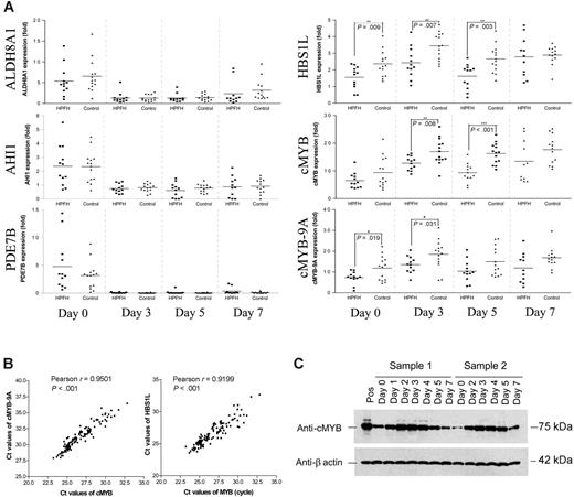 Figure 3. Relative expression of the genes in the 6q23 candidate interval throughout phase II. Gene transcription was determined by real time RT-PCR. Gene expression levels are related to the gene expression of one sample after HPRT normalization. (A) Relative expression of ALDH8A, AHI1, PDE7B, HBS1L, cMYB, and cMYB-9A. Each data point represents the mean value for each individual in the HPFH and control groups. For day 7, values were obtained for only 11 of the 12 HPFH, and 13 of the 14 controls. There were inadequate cell numbers for analysis for culture of one individual in each group. (B) Correlation of cMYB with cMYB-9A or HBS1L expression. The Ct values are a measure of the amount of template mRNA, the lower the Ct value, the higher the amount of mRNA template. The data points include all values, with more than one value for 6 individuals who had repeat erythroid cultures. (C) Western blot analysis of total cell lysates from phase II erythroid cell cultures. Samples 1 and 2 represent 2 different individuals to illustrate the pattern of the cMYB protein expression in phase II. Pos refers to the cell lysate from K562 cells.