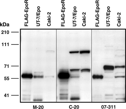 Figure 1. Detection of proteins with anti-EpoR antibodies. M-20, C-20, and 07-311 all detected 59-kDa proteins. C-20 detected a 66-kDa protein, whereas 07-311 detected an approximately 70-kDa protein. Protein extracts were prepared from COS-7 cells expressing FLAG-EpoR, UT-7/Epo cells (50 000 cells/lane), and Caki-2 cells (60 000 cells/lane). Proteins were resolved on a 7% gel and subjected to Western immunoblotting using the antibodies C-20 (0.132 ug/mL), 07-311 (0.1 μg/mL), or M-20 (0.2 μg/mL), as described previously.1 Positions of the molecular weight markers are illustrated on the left (kDa).