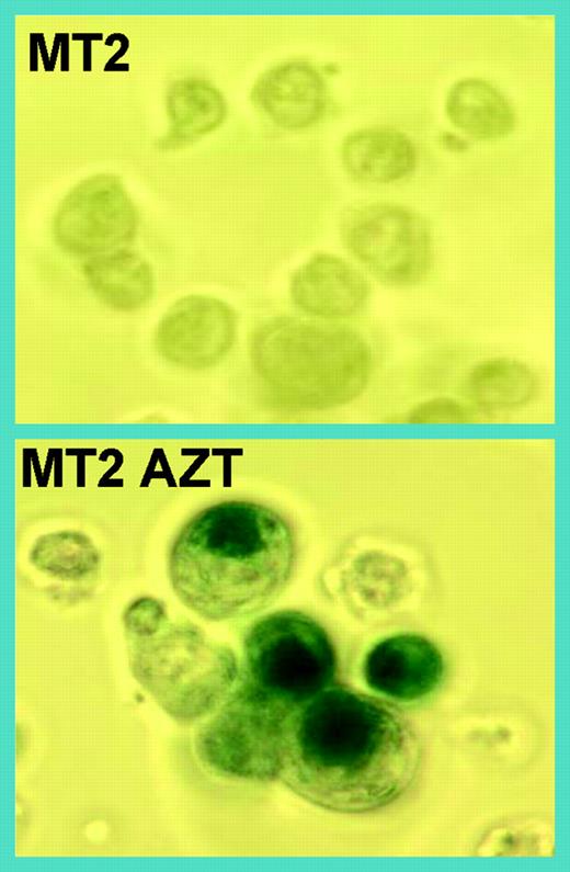 HTLV-I–infected MT2 cells undergo senescence after long-term AZT treatment, as determined by senescence β gal assay. See the complete figure in the article beginning on page 1021.