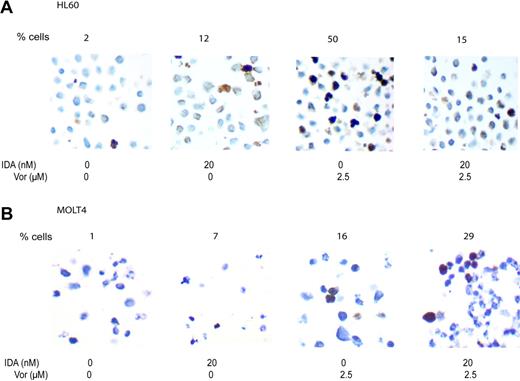 Figure 6. H2AX phosphorylation. HL60 cells (A) and MOLT 4 cells (B) were treated for 8 hours with vorinostat (Vor) 2.5 μM or IDA 20 nM or the combination. H2AX phosphorylation was analyzed using immunohistochemistry in paraffin-embedded cell suspensions. Numbers at the top of each image represent the percentage of cells staining for γH2AX. Images were acquired using a Zeiss Axiovert S100 inverted microscope equipped with a 40×/0.65 objective lens (Zeiss, Thornwood, NY) and a Hamamatsu cooled CCD camera (Hamamatsu, Hamamatsu City, Japan) and were digitally stored with WebSlide Browser (Bacus Laboratory, Lombard, IL). Images were obtained using 100× magnification.