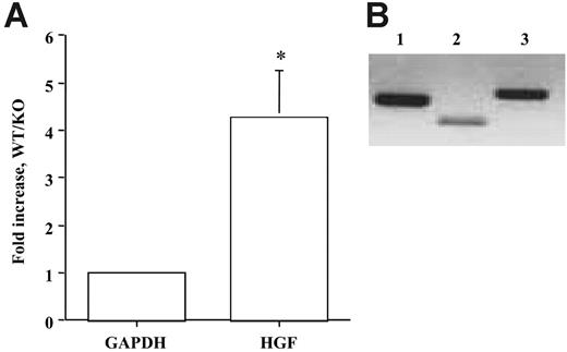 Figure 6. Quantification of HGF levels in Tie2 KO embryos. (A) Real time RT-PCR analysis on HGF levels was performed on wild-type and Tie2 knockout embryo yolk sacs harvested at day 9.5. Gene expression levels were normalized according to the expression of the housekeeping gene GAPDH. HGF expression was decreased 4.26-fold in Tie2-null yolk sacs compared with wild-type controls. Three pairs of embryo tissues were used in the study. RT-PCR was performed in triplicate and with 3 different dilutions of cDNA. *P < .01 compared with control. (B) RT-PCR analysis on HGF was also performed on endothelial cells isolated from the wild-type yolk sac (C166). Two sets of primers for HGF were used to increase specificity. HGF expression was confirmed (lane 2, 300 bp; lane 3, 500 bp). GAPDH was used as a control (lane 1, 440 bp).