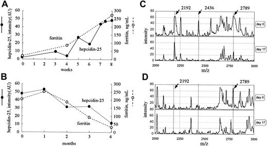 Figure 5. Time courses of clinical cases. (A) Serum levels of both hepcidin-25 and ferritin increased with intravenous iron administration for 8 weeks in a patient with iron deficiency anemia receiving hemodialysis. (B) Serum levels of both hepcidin-25 and ferritin gradually decreased in the period of 4 months in a patient receiving hemodialysis who had massive periodic hemorrhage as a result of menstruation. (C-D) The expression of hepcidin in inflammation. Protein profiling of urine (C) and serum (D) from a patient with acute pyelonephritis before (day 0) and after (day 17) treatment with antibiotics is shown. AU indicates arbitrary unit.