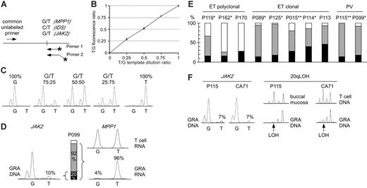 Figure 1. Comparison of clonality and the presence of the JAK2-V617F mutation in MPDs. (A) Design of allele-specific PCR assays for detecting the JAK2-V617F mutation and assessing clonality using the IDS and MPP1 X-chromosomal gene polymorphisms. Horizontal arrows indicate primer positions; fluorescently labeled primers are marked by asterisks. Note that one of the labeled primers is extended by 3 nonhomologous nucleotides to allow separation of the PCR products by size. (B) Analysis of the linearity of the JAK-V617F allele-specific PCR. Quadruplicate reactions were performed on genomic DNAs with known ratios of wild-type and mutant JAK2 alleles. The reactions were performed using homozygous wild-type (G) and homozygous mutant (T) genomic DNA dilutions with increasing proportion of the homozygous mutant DNA. The G and T peak fluorescence ratios were determined and plotted for each genomic DNA dilution. Error bars indicate standard deviation. (C) The chromatograms of 5 DNA samples from panel B are shown. (D) Comparison of clonality determined by X-chromosome inactivation assays with clonality derived from the JAK2-V617F allele-specific PCR in granulocytes (GRA) of one female ET patient (P099). The relative abundance of the mutant JAK2 allele (10%) was calculated by comparing the G and T peak intensities (left). The allelic ratio of 10% T translates to 20% of granulocytes heterozygous for the JAK2-V617F (middle, black bar), or 10% of granulocytes homozygous for the mutation (not shown). Allele-specific PCR assay for the X-chromosomal gene MPP1 is shown at the right. The genomic DNA from patient P099 was heterozygous for a G/T single nucleotide polymorphism (not shown). The relative expression of the 2 MPP1 alleles was determined by comparing the G and T peak intensities obtained by the allele-specific RT-PCR assay in T cells (top chromatogram) and granulocytes (bottom chromatogram). The skewing of expression toward the T allele (96%) translates to the presence of 92% of clonal cells expressing only the T allele (gray bar + black bar), since the remaining 8% of cells that are of polyclonal origin (white bar) express equal amounts of both alleles. (E) Comparison of clonality in patients with ET and PV. Black bars, clonal granulocytes that carry the JAK2-V617F mutation; gray bars, clonal granulocytes that carry the wild-type JAK2 allele; white bars, polyclonal granulocytes. Analysis of T-cell RNA was performed where material was available: *Polyclonal T cells; **Skewed T cells (Figure S2). (F) Comparison of clonality determined by microsatellite PCR for loss of heterozygosity (LOH) on chromosome 20q and clonality defined by the presence of the JAK2-V617F mutation. Allele-specific PCR for JAK2-V617F for 2 patients (P115 and CA71) revealed that only 14% of granulocytes carry the JAK2-V617F mutation (allelic ratio of the T allele = 7%, left panel). In the same 2 patients, LOH (arrows) in the minimal deleted region on chromosome 20q was found in the vast majority of granulocyte DNA (right panel).