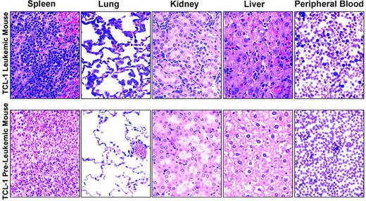 Figure 2. Hematoxylin and eosin–stained tissues and blood smears from TCL-1 leukemic and preleukemic mice. Images were visualized using an Olympus BX41 microscope (Olympus, Melville, NY) as well as 40 ×/0.65 numeric aperture (NA) and 60 ×/0.80 NA plan objectives for tissue sections and blood smears, respectively. Photographs were taken using an Olympus C-3040 camera, and images were acquired and processed using Adobe Photoshop (Adobe Systems, San Jose, CA) in the OSU Mouse Phenotyping Shared Resource facility.