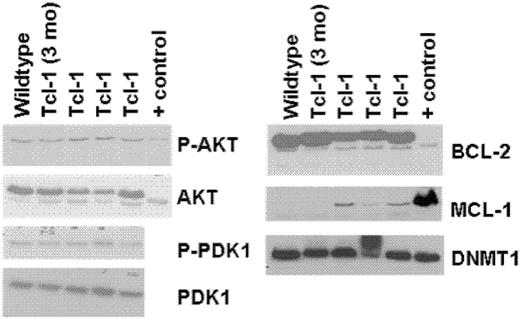 Figure 3. Immunoblots of whole-cell lysates from spleens of TCL-1 leukemic, nonleukemic, and wild-type (C3H/B6) mice. Positive control for Bcl-2, Mcl-1, and DNMT1 is whole cellular lysate from Jurkat cell line. Positive control for AKT is from the 697 cell line.