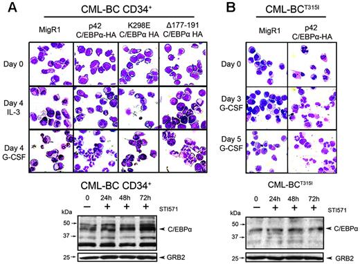 Figure 8. Effect of C/EBPα in CML-BC cells. (Top panel) Induction of granulocyte differentiation by constitutive expression of C/EBPα in CML-BC cells. Bone marrow CD34+ cells (A) or peripheral blood blasts (B) from 2 CML-BC patients were retrovirally transduced with the MigRI empty vector or with wild-type or mutant C/EBPα. After sorting, GFP-positive cells were cultured in the presence of IL-3 or G-CSF and were assessed (May-Grünwald/Giemsa staining of cytospins) for morphologic differentiation. (Bottom panel) Western blot analysis shows C/EBPα expression in untreated and STI571-treated cells of the 2 patients with CML-BC. GRB-2 levels were measured as control of equal loading.
