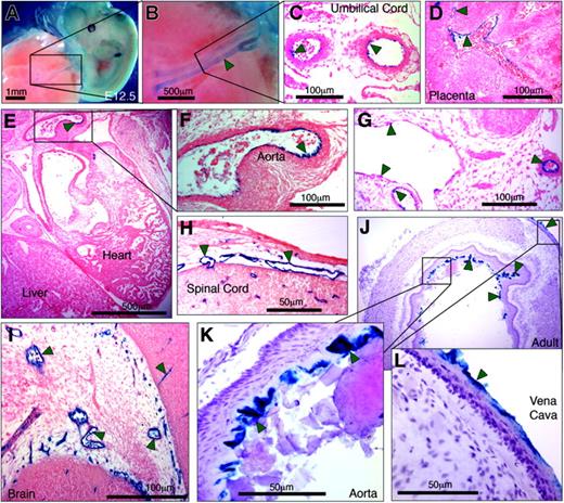 Figure 6. Six kilobases of the hEPCR 5′-flanking region transcriptionally targets ECs in transgenic mice. Transgenic mice containing 6 kb of the hEPCR 5′-flanking region coupled to LacZ were generated. Embryos (A-I) and adult tissues (J-L) were analyzed. Embryos were harvested at E12.5 and whole-mount stained with X-gal (A-B). Thereafter stained embryos were wax embedded, sectioned, and counterstained with eosin (C-I). Sites of LacZ expression are dark blue (green arrows). In whole-mount stained embryos, staining in the umbilical vessels was apparent (A-B), which was confirmed as endothelial in tissue sections (C). Transgene expression was also specifically detected in ECs of large placental veins (D), aorta (E-F), and certain other larger veins and arteries (G). EC-specific expression was also seen in small vessels surrounding the spinal cord (H) and in the developing brain (I). Tissues from adult transgenic mice were stained with X-gal and counterstained with hematoxylin (J-L). Reporter gene expression was specifically detected in the endothelium lining the aorta and vena cava (J-L). Microscope images were captured using a Nikon 55i microscope coupled to a DSL1 camera and EclipseNET software (Nikon, Knighton-upon-Thames, United Kingdom). Objectives used were 1×/0.75 NA (panels A, B), 20×/0.75 NA (panels C, D, F-I, K, L), and 2×/0.75 (panels E, J).