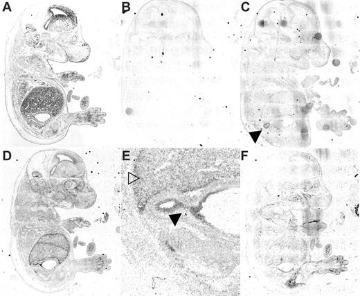 Figure 3. Steap mRNA expression by in situ hybridization. E15.5 mouse embryo sections were analyzed for Steap mRNA expression by 35S-radioactive in situ hybridization. (A) Bright field image; (B) inverted dark field negative control probe (Steap1 sense RNA); (C) Steap1 (antisense RNA), note adrenal staining (▸); (D) Steap2 (antisense RNA); (E) Steap2 higher magnification of the liver (▾) and gastroduodenal junction (▸); (F) Steap4. Checkerboard background is the result of assembling the low-power image from multiple high-power images using Compix software (see “Materials and methods”).