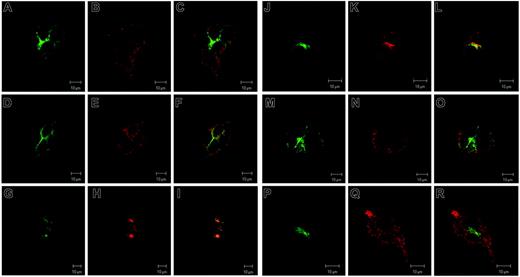 Figure 4. Steap subcellular localization. Colocalization of epitope-tagged Steap family members with Tf and endogenous TfR1. (A) Steap1, (B) Tf, (C) Tf-Steap1 merged; (D) Steap1, (E) TfR1, (F) TfR1-Steap1 merged; (G) Steap2, (H) Tf, (I) Tf-Steap2 merged; (J) Steap2, (K) TfR1, (L) TfR1-Steap2 merged; (M) Steap4, (N) Tf, (O) Tf-Steap4 merged; (P) Steap4, (Q) TfR1, (R) TfR1-Steap4 merged.