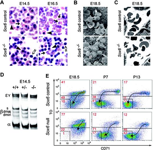 Figure 1. Sox6–/– mice feature abnormal RBCs and are anemic. (A) Blood smears of E14.5 and E16.5 Sox6–/– and control littermates. Arrowheads indicate large and nucleated primitive RBCs; arrows, small, enucleated, definitive RBCs; and double arrows, Sox6–/– nucleated and misshapen definitive RBCs. (B) Scanning electron microscopy (SEM) of E18.5 Sox6–/– and control RBCs. D indicates normal-looking discoid RBCs; *, SEM artifacts; and #, misshapen RBCs. (C) Transmission electron microscopy of RBCs in E18.5 Sox6–/– and control littermates. Nucleated and abnormally shaped RBCs are seen in the Sox6–/– fetus. (D) Globin chain analysis in E14.5 Sox6–/– and control fetuses. The migration level of the primitive Eγ globin chains, definitive β-globin haplotypes, and α-globin chains is indicated. The Sox6–/– mutant shows the same proportions of primitive and definitive globin chains as its control littermates. (E) TO/CD71 FACS profiles of blood cells in control and Sox6–/– mice from E18.5 to P13. Thiazole orange, which binds nucleic acids, distinguishes nucleated cells (TO++) from reticulocytes (TO+) and mature RBCs (TO–), and CD71 antibodies distinguish reticulocytes (CD71+) from mature RBCs (CD71–). Arrows indicate the trend of reticulocyte (CD71+/TO+) differentiation into mature RBCs (CD71–/TO–).