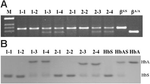Figure 2. Genomic DNA and hemoglobin analysis of mice derived from targeted ES cell lines 1 and 2. (A) After removal of the PGK/Hygro marker from corrected ES cell clone 1 (–1400 γ-βA/–1400 γ-βS) and clone 2 (–383 γ-βA/–1400 γ-βS), cells were injected into C57BL/6 blastocysts. Chimeric males obtained from these blastocysts were mated with hα/hα, –1400 γ-βS/mβ females and offspring were screened for the corrected genotypes (–1400 γ-βA/–1400 γ-βS and –383 γ-βA/–1400 γ-βS) by PCR of tail DNA and Bsu36I digestion. (B) IEF gel of hemolysates from mice identified as sickle and corrected animals in panel A. The last 3 lanes are human control hemolysates from a sickle patient, an individual with sickle trait, and an unaffected individual. Of interest, the ratio of HbA to HbS in corrected animals mimics the ratio in humans with sickle trait.