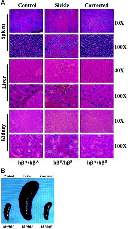 Figure 4. Amelioration of spleen, liver, and kidney pathology in –383 γ-βA– corrected mice. (A) Spleen, liver, and kidney sections were analyzed at low (10×/0.45 NA objective for spleen and kidney, 40×/0.75 NA objective for liver) and high (100×/1.40 NA oil objective) magnification. In –383 γ-βA–corrected mice, normal splenic red and white pulp is observed, and virtually no pools of sickle erythrocytes or infarcts are evident. In livers of –383 γ-βA animals, focal areas of necrosis and aggregation of sickled erythrocytes are not observed; also, extramedullary hematopoiesis and hemosiderin deposition are absent. Kidneys of –383 γ-βA mice appear normal and free of the disruptive vascular RBC pooling. All sections were stained with hematoxylin-eosin. (B) Correction of splenomegaly in –383 γ-βA–corrected mice. Data from –1400 γ-βA–corrected mice are identical to –383 γ-βA–corrected animals.