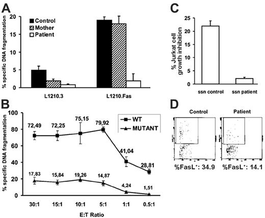 Figure 2. Fas/FasL-mediated cytotoxicity. (A) T-cell blasts from a healthy control, the mother, and the patient were stimulated with PMA plus ionomycin (P+I) and tested for cell-mediated FasL-induced cytolytic activity using L1210 cells transfected (L1210.Fas) or not (L1210.3) with Fas as targets at a fixed 5:1 E/T ratio in 16-hour cytotoxicity assays. (B) COS-7 cells were transfected with an expression vector containing the wild-type (WT) FASL allele or the mutant FASL allele from the patient. Forty-eight hours after transfection, transfected COS-7 cells were tested against L1210 Fas target cells at the indicated E/T ratios in 6-hour cytotoxicity assays. (C) Supernatants (ssn) from P+I-stimulated T-cell blasts from the healthy control and the patient were collected and tested for cell-free FasL-induced toxicity on Jurkat cells, as described in “Patient, materials, and methods.” (A-C) Results are the mean ± SD of at least 3 different experiments. (D) Exosomes secreted by human T-cell blasts from the healthy control and the patient after P+I stimulation were labeled with H11-FITC and analyzed by flow cytometry using a gating protocol specific for microvesicles/exosomes. Percentage of FasL+ exosomes in each case is shown.