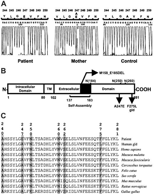 Figure 3. Schematic representation of the FasL protein and alignment of sequences. (A) Exon 4 sequence analysis of FASL. The homozygous and heterozygous mutation (A247E) is shown in the patient and her mother, respectively. (B) In the extracellular part of the protein are shown the self-assembly domain32; the heterozygous deletion of 28 amino acid (M158_E185DEL)15; 3 potential N-glycosylation sites at asparagines 184, 250, and 260 residues; the mutation characterized that changes an alanine for a glutamic acid (A247E); and the gld human FasL construct prepared with the corresponding mutation found in gld mice (F275L in the human sequence).32 (C) Alignment of the COOH terminal portion of the FasL protein, demonstrating the highly conserved amino acids A240, A247, N260, S262, and F275. Aligned FasL sequences are from the patient (GenBank accession no. AY858799), gld human FasL construct, Homo sapiens (GenBank accession no. AY225406), Macaca mulatta (GenBank accession no. AB035139), Macaca fascicularis (GenBank accession no. AB035138), Cercocebus torquatus (GenBank accession no. AF344847), Felis catus (GenBank accession no. NM_001009352), Sus scrofa (GenBank accession no. NM_213806), Mus musculus (GenBank accession no. NM_010177), Rattus norvegicus (GenBank accession no. NM_012908), and Gallus gallus (GenBank accession no. AJ890143).