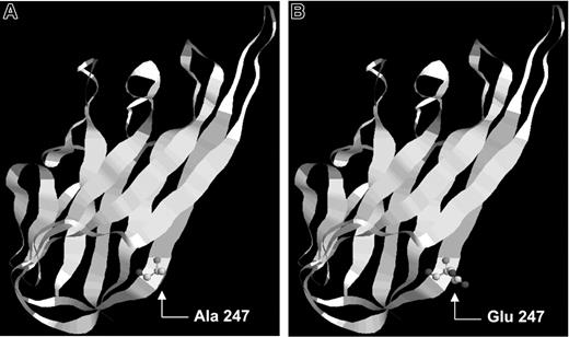Figure 4. Representation of the location of the described FasL mutation. FasL protein is formed by 8 β-strands: A, B, C, D, E, F, G, and H. (A) Wild-type FasL protein showing alanine in position 247. (B) Mutant FasL protein showing glutamic acid in residue 247.