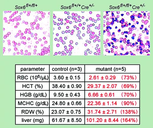 Dumitriu and colleagues have used a new conditional knock-out mouse model for Sox6 to study definitive erythropoiesis in the fetal liver. These studies confirm previous findings with Sox6–/– mice and now demonstrate that EPO receptor–mediated deletion of Sox6 in committed erythroid progenitors is additive with EPO for maturation, proliferation, and survival. This figure demonstrates the increase in nucleated red blood cells, anemia, and increase in erythropoietic tissue volume associated with conditional deletion. Of importance, this approach indicates that Sox6 functions in a cell-intrinsic manner to regulate erythroid development and suggests that Sox6 may be an important new therapeutic target. See the complete figure and table in the article beginning on page 1198.