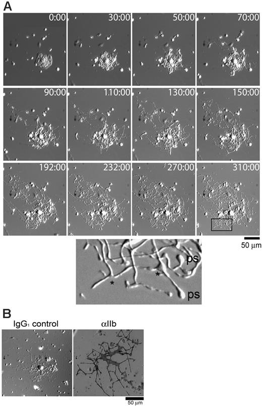 Figure 1. Primary, uncultured megakaryocytes can rapidly produce proplatelets on fibrinogen. (A) Bone marrow aspirates were prepared as described in “Materials and methods” and plated onto fibrinogen-coated 25-mm glass coverslips. The cells were allowed to adhere for 1 hour at 37°C, then the coverslips were rinsed and transferred to a microincubation chamber. The chamber was placed into a humidified microscope chamber at 37°C and 5% CO2, and images were taken at the indicated time points (minutes). The enlarged area is from the box at time point 310:00 minutes. Branching points are indicated with an asterisk, and visible platelet swellings are labeled “ps.” Other cells, such as red blood cells and macrophages, are visible within the fields of view. The complete movie can be viewed on the Blood website (Video S1). (B) Proplatelets from primary megakaryocytes are αIIb-positive. Cells were allowed to adhere to fibrinogen-coated coverslips for 4 hours at 37°C, then fixed and stained for αIIb via alkaline phosphatase. Dark staining was observed only when the αIIb-specific antibody was used (right panel), and not the IgG1 control antibody (left panel).