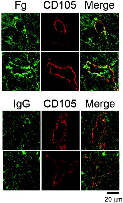 Figure 4. Fibrinogen is localized at vascular sinusoids in the bone marrow. Representative images from frozen murine femur sections costained with an FITC-conjugated anti-mouse fibrinogen antibody or an IgG control antibody together with a biotin-linked anti-CD105 antibody preincubated with Texas Red-linked streptavidin. The tissue sections were visualized via confocal microscopy. Note that while sinusoidal gaps are visible in the control stain, there is no enrichment of green staining around the periphery of the sinusoid. Results are representative of 4 separate experiments.