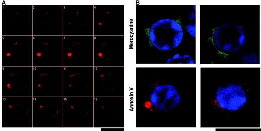 Figure 7. Merocyanine 540 and annexin V preferentially bind to membrane blebs on calcium ionophore-stimulated lymphocytes. Confocal sections of murine mesenteric lymph node cells are shown. Lymphocytes from C57BL/10 mice were stimulated with 10 μM calcimycin and stained with 1 μM MC540 (green) or annexin V AlexaFluor 568 (red). DAPI staining of nuclear DNA is in blue. Scale bars indicate 10 μm. (A) Stack of confocal sections separated by 0.3 μm increments showing membrane blebs. (B) Single confocal sections.