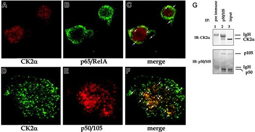 Figure 7. CK2 associates with NF-κB in MM cells. (A-C) Confocal immunofluorescence microscopy of CK2 (Texas red), NF-κB p65/RelA (green, Alexa 488), and merge showing scant colocalization (white arrows) of the 2 proteins in the cytoplasm in OPM2 cells. (D-F) Confocal immunofluorescence microscopy of CK2 (green, Alexa 488), NF-κB p50/105 (Texas red), and merge showing abundant colocalization (white arrows) of the 2 proteins in the nucleus in OPM2 cells (600× magnification, oil, top panels, 1000× magnification, oil, bottom panels). (G) Association of endogenous CK2α and NF-κB p50/105 in MM cells. Coimmunoprecipitation of endogenous CK2α and NF-κB p50/105 in OPM2 MM cells. Cell lysates were immunoprecipitated with a preimmune rabbit serum (lane 1) or with an antibody recognizing p50/105 (lane 2) and then immunoblotted for CK2α (top) and NF-κB p50/105 (bottom). Input loading is shown in lane 3.