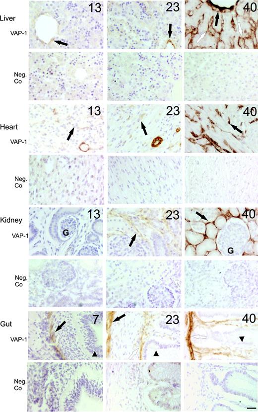 Figure 1. Time-dependent induction of VAP-1 in parenchymal organs during fetal development in man. Representative immunohistochemical stainings of VAP-1 in liver (black arrow indicates central vein; white arrow, sinusoid), heart (black arrow, capillary), kidney (black arrow, intertubular capillaries; G indicates glomerulus) and gut (black arrow, gut wall; white arrow, muscularis mucosae; arrowhead, epithelium) at the indicated weeks of gestation are shown. Negative control (Neg.Co) stainings from the same specimens are also shown (lower row for each organ). Scale bar indicates 50 μm. Objective magnification for all images, 20×.