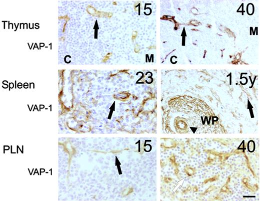 Figure 2. The expression of VAP-1 in lymphoid organs during the ontogeny in humans. Representative immunohistochemical stainings of thymus (black arrow indicates vessel; C, cortex; M, medulla), spleen (black arrow, vessel; arrowhead, central arteriole; WP, white pulp) and PLN (black arrow, venule; white arrow, high endothelial venule) are shown. The gestational age (weeks, except the right-hand panel of a spleen that is 1.5 years) is shown in the top right corner. Scale bar indicates 50 μm. Objective magnification for all images, 20×.