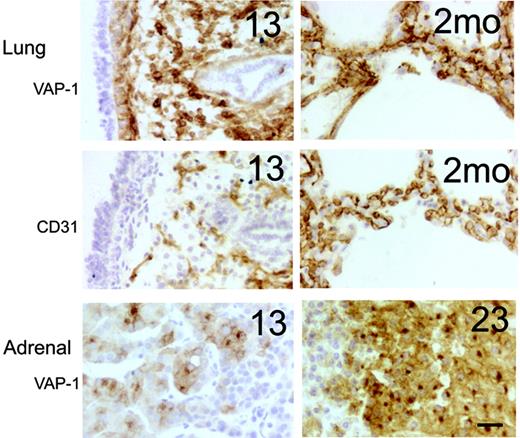 Figure 3. Prominent synthesis of VAP-1 in embryonic lung and adrenal gland. Representative immunohistochemical stainings from fetal (13 weeks) and postnatal (2 months) lungs and fetal adrenal glands (13 and 23 weeks) are shown. Adjacent sections of the lungs were stained for VAP-1 and CD31 (an endothelial marker). Scale bar indicates 50 μm. Objective magnification for all images, 20×.