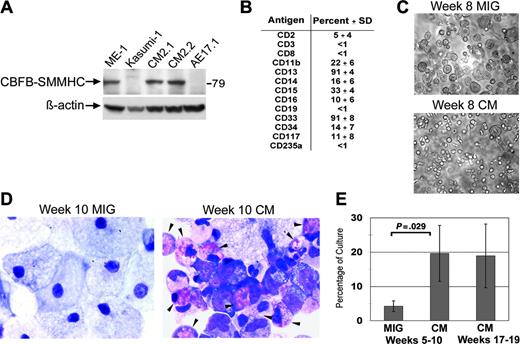Figure 3. Long-term cultures expressing CM exhibit a myelomonocytic phenotype with eosinophilia. (A) Long-term cultures expressing CM or AE, and leukemia cell lines from patients with inv(16) (ME-1) or t(8;21) (Kasumi-1) were analyzed by Western blot using an anti-CBFβ antibody. (B) Surface marker expression of long-term CM cultures expressed as averages of 4 independent cultures with SDs. (C) Photographs of typical cultures transduced with MIG or CM and grown for 8 weeks. (D) Wright-Giemsa-stained cytospins of week 10 MIG and CM cultures, with eosinophils indicated by the arrows. (E) Average eosinophil counts determined by Wright-Giemsa staining of 4 independent MIG- and CM-matched cultures (5-10 weeks in culture) and 3 independent longer-term (week 15-20) CM cultures. Error bars represent SD.