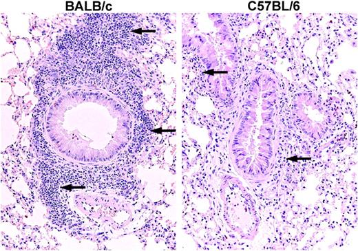 Figure 2. Histology of BALB/c and C57BL/6 mouse lung after OVA sensitization and 3 days of aerosolized OVA challenge. Both strains show an inflammatory response around the bronchovascular bundles after 3 OVA challenges (arrows), the routine time for assessment of lung MCp's. The lung from the BALB/c mouse (left panel) shows much more leukocyte infiltration than does the lung from the C57BL/6 mouse (right panel).