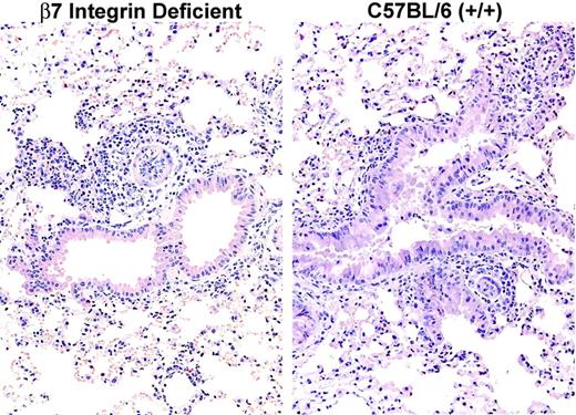 Figure 6. Histology of β7 integrin-deficient and C57BL/6 mouse lung after OVA sensitization and 3 days of aerosolized OVA challenge. The lung from the β7 integrin-deficient mouse (left panel) shows leukocyte infiltration around the bronchovascular bundles, similar to that observed in lung from the wild-type C57BL/6 mouse treated in parallel (right panel).