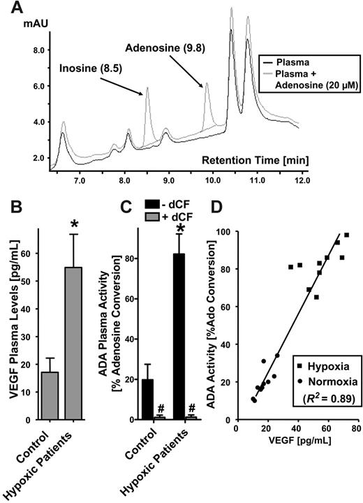 Figure 6. Plasma ADA enzyme activity is increased in patients with hypoxia. (A) To develop a technique for measuring ADA activity in plasma, different concentrations of adenosine were added to the plasma and assessed for dCF-inhibited inosine generation. Optimal resolution was found with using 20 μM adenosine (black line indicates plasma alone; gray line, plasma after addition of 20 μM adenosine). (B-C) VEGF and ADA are increased in the plasma of patients with hypoxia. Plasma samples were obtained from 10 pediatric patients with chronic hypoxia (mean oxygen saturation of 82%) undergoing cardiac surgery (bidirectional Glenn procedure) and 10 age- and sex-matched controls (mean oxygen generation of 96%) undergoing noncardiac surgery. Plasma VEGF was measured with standard ELISA technique. ADA activity was measured via HPLC as percent adenosine conversion to inosine. *Significant differences with hypoxia (P < .01). #Differences with dCF treatment (100 nM; P < .001). (B-C) Error bars indicate SD. (D) Correlation of ADA plasma activity with VEGF plasma levels displayed for individual patients (▪, hypoxia) and control patients (•, normoxia). Note the strong correlation between ADA activity and circulating VEGF levels (r2 = .89, P < .01). The diagonal represents the linear regression line.