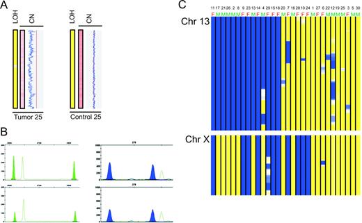 Figure 4. Analysis of chromosome 13 in myeloma samples. (A) Tumor sample 25 has monosomy of chromosome 13 without LOH, compared to the matched control. Figure 1 provides a description. (B) Quantitative analysis of short terminal repeats using the Powerplex 16 System shows that tumor sample 25 (bottom panels) has half the amount of both alleles of marker D13S317 (green peaks) on chromosome 13 compared to the matched control (top panels). Analysis of other chromosomes, including chromosome 21 (marker D21S11, blue peaks), showed matching amounts of both alleles. Internal markers are shown as clear peaks. (C) LOH profiles of 30 myeloma samples, clustered according to LOH frequency by dChip, show that female samples with del(13) always have LOH of chromosome X. Top panel, chromosome 13; bottom panel, chromosome X. Regions of LOH are shown in blue and regions of heterozygosity in yellow. Sex of samples indicated at the top of each lane: M indicates male and F, female. Male samples do not show LOH (blue) on chromosome X due to homozygosity occurring naturally.