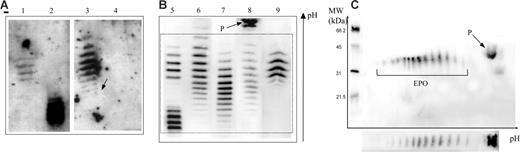 Figure 1. Epo profiles obtained by double-blotting. Panel A is reproduced from Beullens et al.1(Fig1A), and panels B and C are results from our laboratory. (A) Lane 1 shows epoetin β; lane 2, darbepoetin α; lane 3, urine sample considered as “false positive” (the arrow shows a white hole corresponding to ineffective transfer of proteins in this area); and lane 4, the same sample as in lane 3 1 hour later. (B) Lane 5 shows a mixture of epoetin β and darbepoetin α; lane 6, natural urinary Epo from a sample taken after strenuous exercise (note some shift toward the cathode of the banding pattern); lane 7, natural urinary Epo; lane 8, urine sample showing the protein (P) unrelated to Epo outside the window of integration (dotted box) used for interpretation of an antidoping control result; and lane 9, urine sample in case of epoetin administration (note the difference with the natural urinary Epo pattern even in the case of the post-strenuous exercise sample). (C) Two-dimensional electrophoresis of a urine sample showing both Epo and protein P.