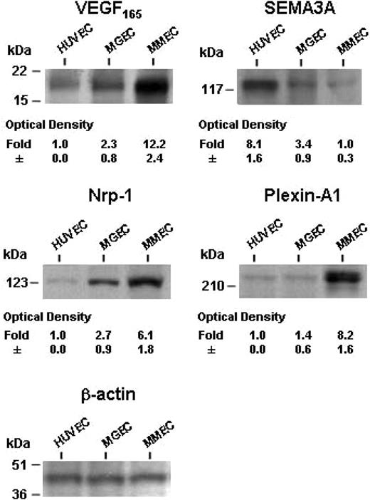 Figure 2. Protein levels of VEGF165 and SEMA3A in CM and of NRP1 and plexin-A1 in EC lysates of patients and HUVECs as measured by Western blot analysis. Data are expressed as mean plus or minus 1 SD in each group. The gel is from the patients' and HUVEC samples shown in Figure 1.