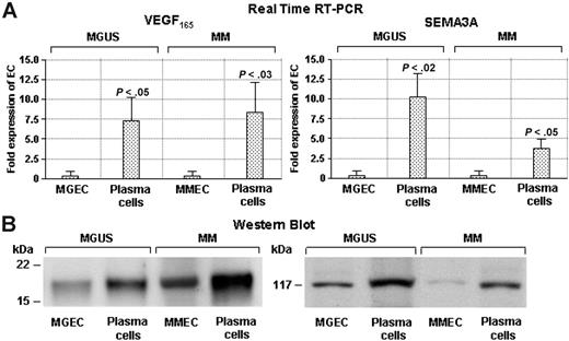 Figure 3. Expression levels of VEGF165 and SEMA3A in MGUS and MM plasma cells compared with paired ECs. (A) Real-time RT-PCR shows data as fold expression of the lowest transcribed value. (B) Western blot analysis of cell CM shows that VEGF165 and SEMA3A protein levels vary in parallel with their mRNA in 2 representative patients with MGUS and MM, respectively. Significance of changes determined by the Wilcoxon-Wilcox test.