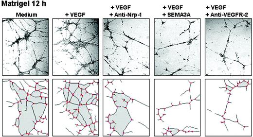 Figure 6. Capillarogenesis on Matrigel. MMECs of a representative patient were seeded on Matrigel in serum-free medium (SFM). After a 12-hour incubation, their 3-D organization in response to the indicated agents was examined through a Leitz Labiovert inverted phase-contrast light microscope (Leitz, Wetzlar, Germany), using a 20×/0.50 numeric aperture objective. Images were processed and analyzed using a Leica QWin computed image analysis software (Leica Imaging Systems, Cambridge, United Kingdom). The areas are shaded, the vascular branching points are red.