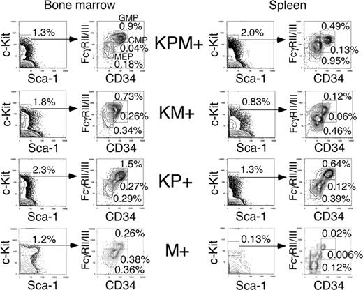 Figure 4. Analysis of myeloid progenitors in bone marrow and spleen of APL-diseased KPM+, KM+, nondiseased KP+, and control M+ (pI-pC treated Mx1-Cre) mice. Quadrants represent the gated populations of myeloid progenitors (IL-7Rα-Lin-Sca1-c-Kit+), CMPs (FcγRloCD34+), GMPs (FcγRhiCD34+), and MEPs (FcγRloCD34-), whose percentages relative to whole bone marrow and spleen are indicated.