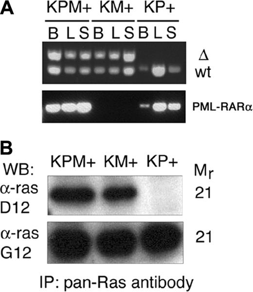 Figure 5. Cre-mediated activation and expression of the oncogenic K-ras allele. (A) PCR for 285-bp wild-type (WT) and 315-bp activated (Δ) K-ras alleles demonstrate presence of the activated allele in KPM+ and KM+ tissues. PCR demonstrates presence of PML-RARα transgene in KPM+ and KP+ tissues. B indicates bone marrow; L, liver; S, spleen. (B) Oncogenic K-ras expression in diseased KPM+ and KM+ spleens. Pan-ras antibody immunoprecipitates of spleen cell lysates were immunoblotted with antibodies specific for 21-kDa wild-type ras (α-ras G12) and oncogenic ras G12D (α-ras D12) proteins. WB indicates Western blot; IP, immunoprecipitation.