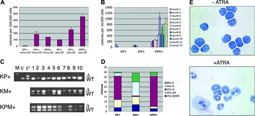 Figure 6. Bone marrow cells from KPM+ mice with APL demonstrate growth factor-independent colony forming activity and enhanced serial replating properties, and differentiate in response to ATRA in methylcellulose cultures. (A) Colony forming activity of KPM+, KM+, and nondiseased KP+ bone marrow cells in the presence (plus) or absence (minus) of growth factors (GF: IL-3, IL-6, SCF, EPO). Data shown are representative of 3 independent experiments. Values shown represent the mean of duplicate cultures from one representative experiment. (B) Serial replating activity of KPM+ bone marrow cells in the presence of growth factors. Data shown is representative of 3 independent experiments. Values shown are the mean of duplicate cultures from one representative experiment. (C) PCR for wild-type (WT) and oncogenic lox-K-ras G12D (Δ) K-ras alleles demonstrates presence of the oncogenic lox-K-ras G12D allele in individual methylcellulose colonies derived from KPM+ and KM+ bone marrow. M indicates molecular weight marker; c-, negative control DNA; c+, positive control DNA. (D) Quantitation of BFU-E, CFU-M, CFU-G, CFU-GM, and CFU-GEMM colonies from KPM+, KM+, and nondiseased KP+ bone marrow cultured in the presence of growth factors. Note predominance of CFU-G colonies derived from KPM+ and nondiseased KP+ bone marrow and CFU-M colonies from KM+ bone marrow. (E) Cytospins (Wright-Giemsa stain) of pooled methylcellulose colonies from KPM+ bone marrow cells cultures in the presence and absence of 1 μM ATRA. Original magnification, × 100.