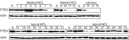 Figure 7. Loss of PTEN contributes to the activation of Akt in a subset of cases. Western blot analysis for PTEN was performed for all MCL cases and cell lines. SUDHL-1 (S) served as positive control. PTEN expression was decreased in 5 of 17 (29%) cases with activated Akt, including 4 high-expressing blastoid MCL (cases 8, 10, 11, 12) and 1 low-expressing typical MCL (case 24). In contrast, 1 of 14 cases without detectable Akt activation (case 25) showed decreased expression of PTEN. Actin is shown as loading control.